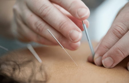 Overcoming the Needle